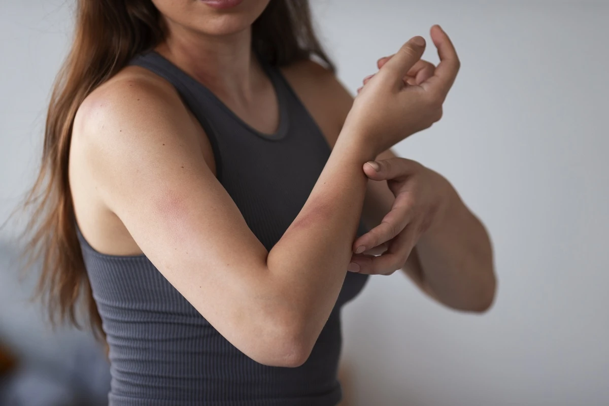 Histamin intoleransı alerjiyle karıştırılabilir: Uzman ne öneriyor?