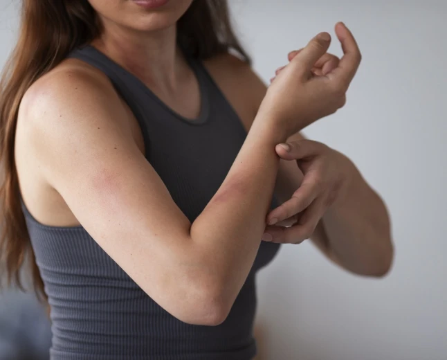 Histamin intoleransı alerjiyle karıştırılabilir: Uzman ne öneriyor?